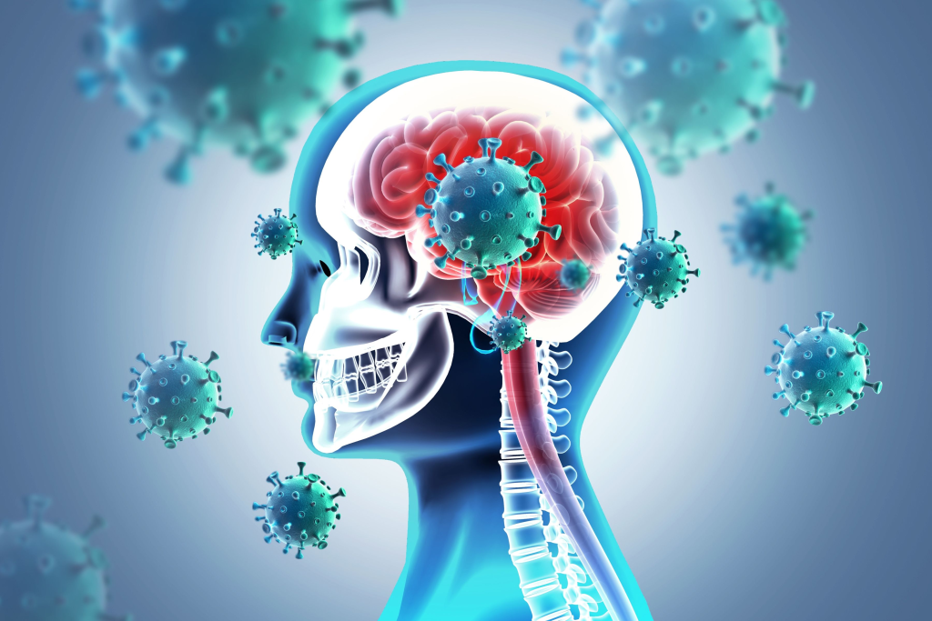 Meningitis Brain Image