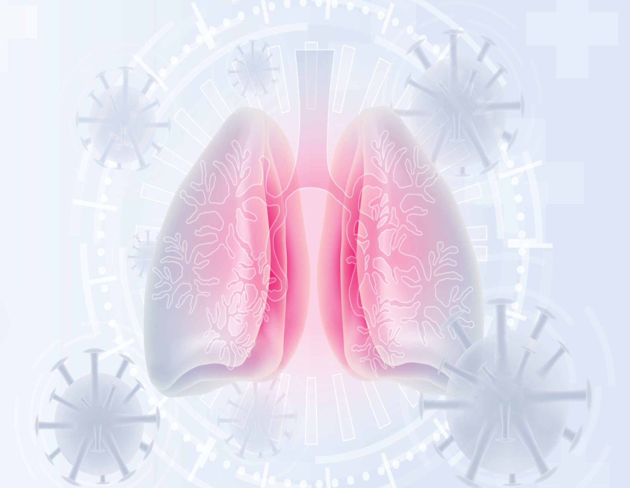 Aspiration Pneumonia LexiMed