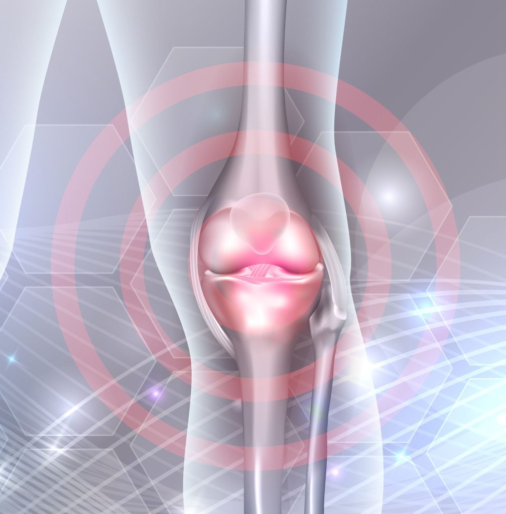 Image of The Knee