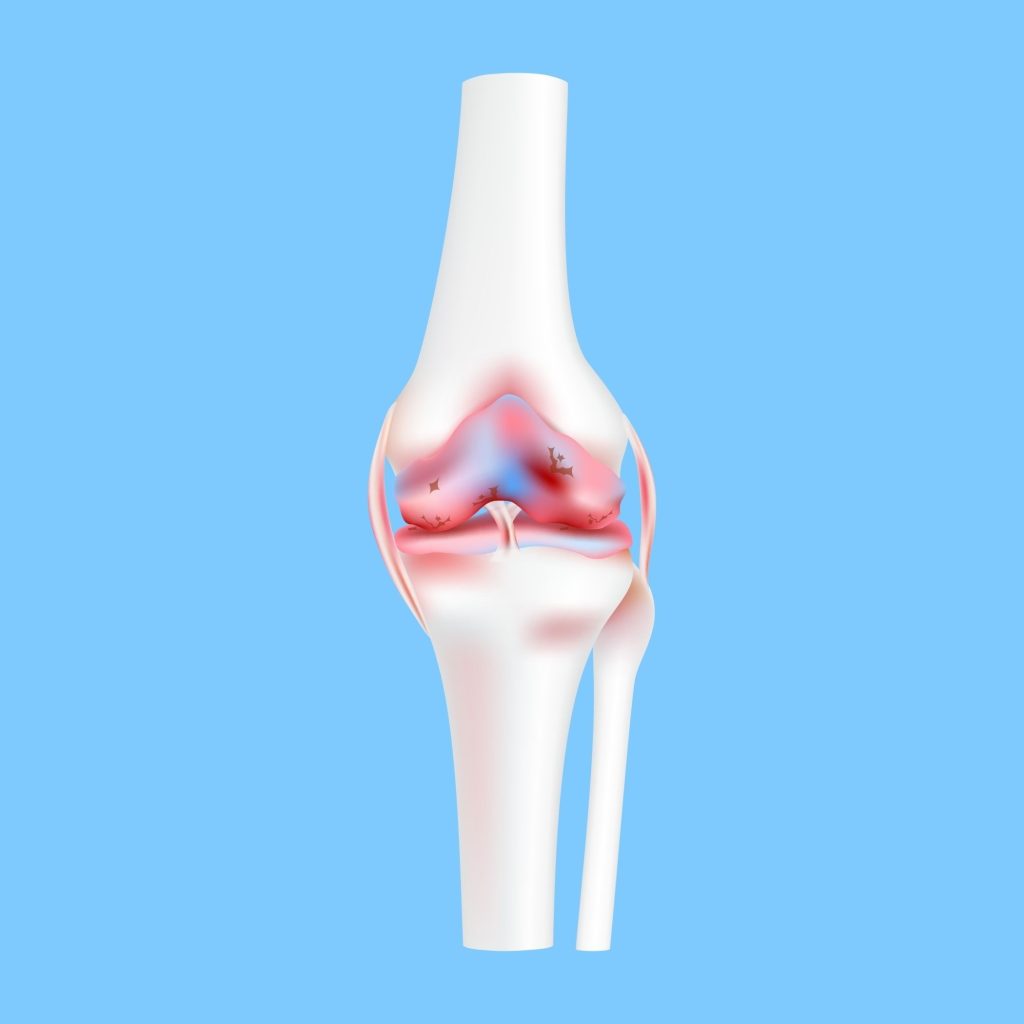 Knee Image